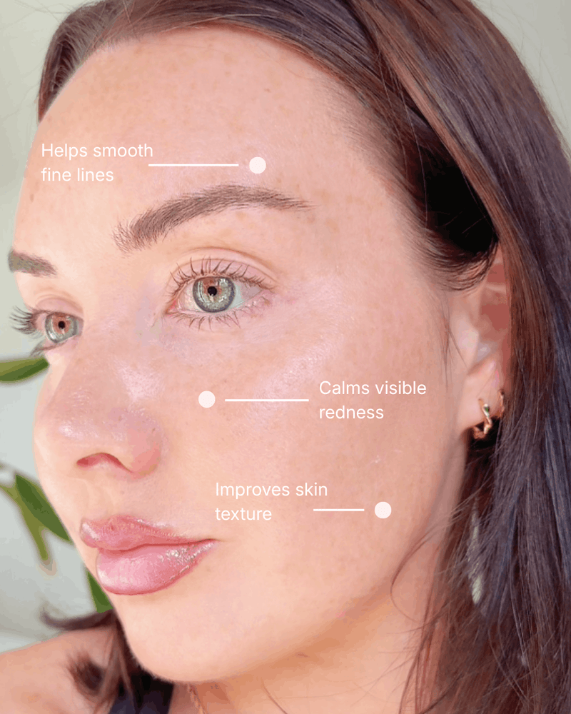 Emora Red Light Therapy Device