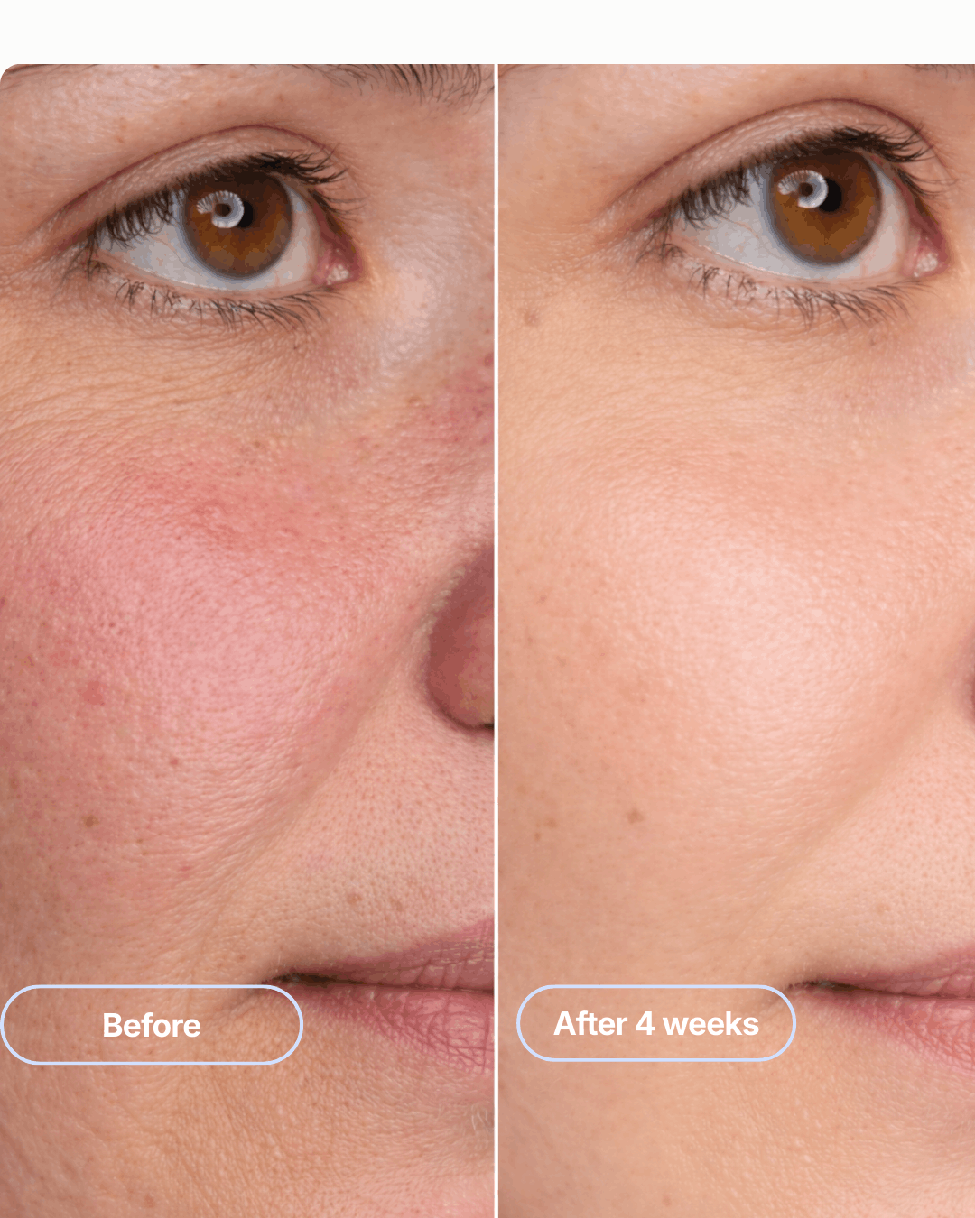 The Emora Essential Kit