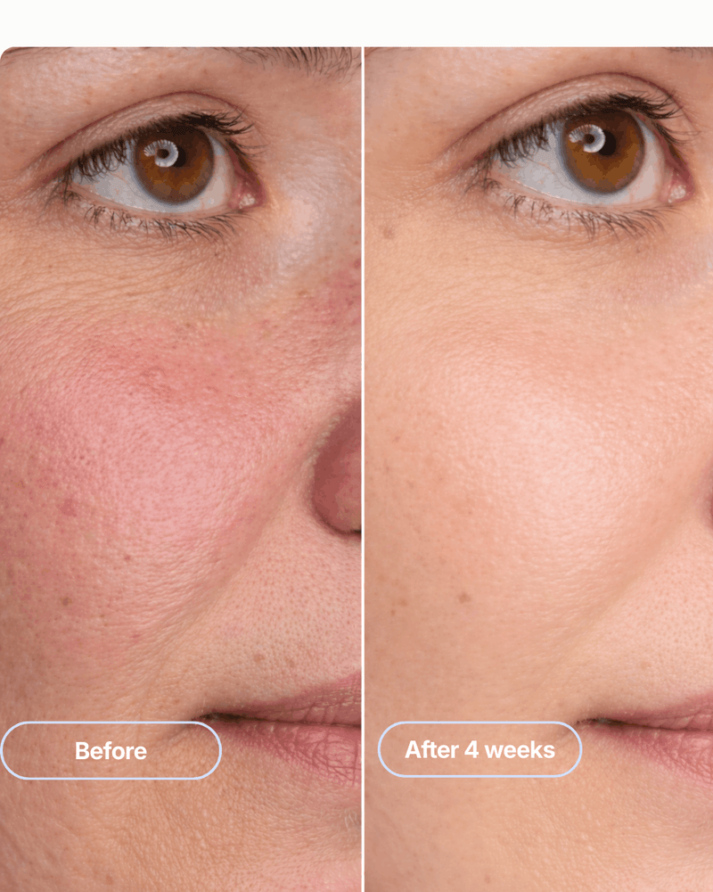 Emora Red Light Therapy Device